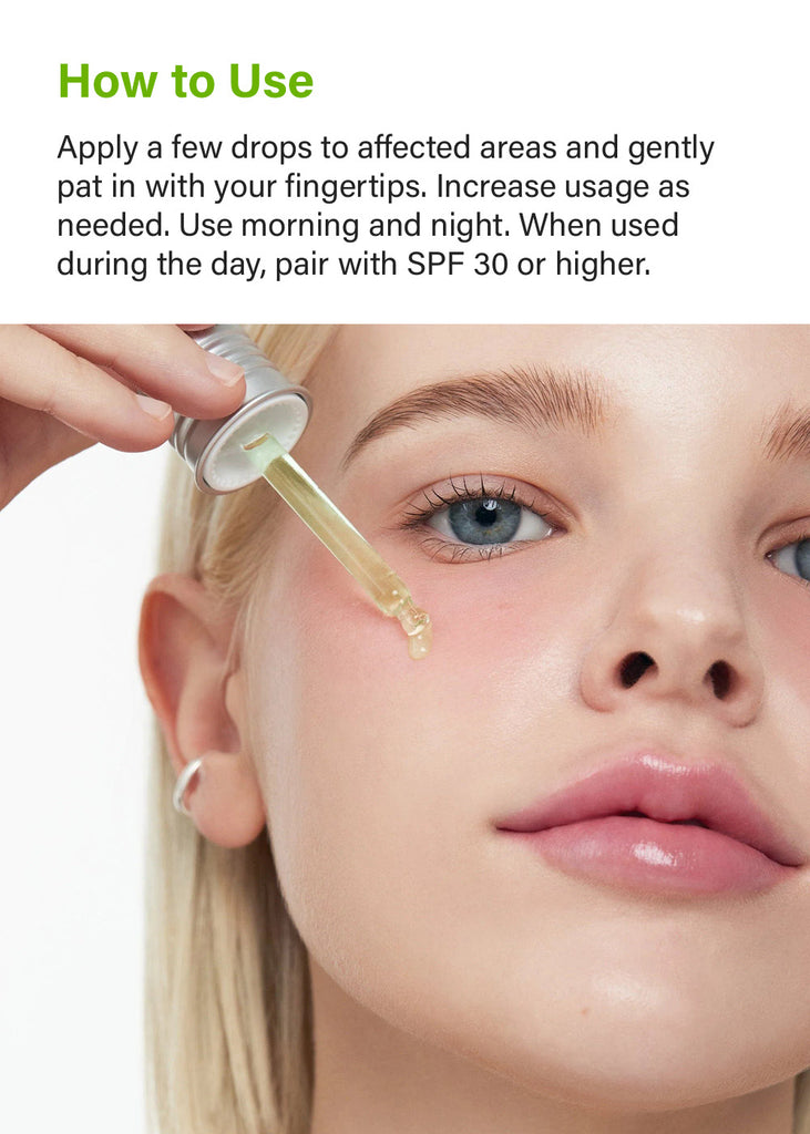 Anua Azelaic Acid 10 Hyaluron Redness Soothing Serum 30ml Seoul Scandal - Shop Miss A