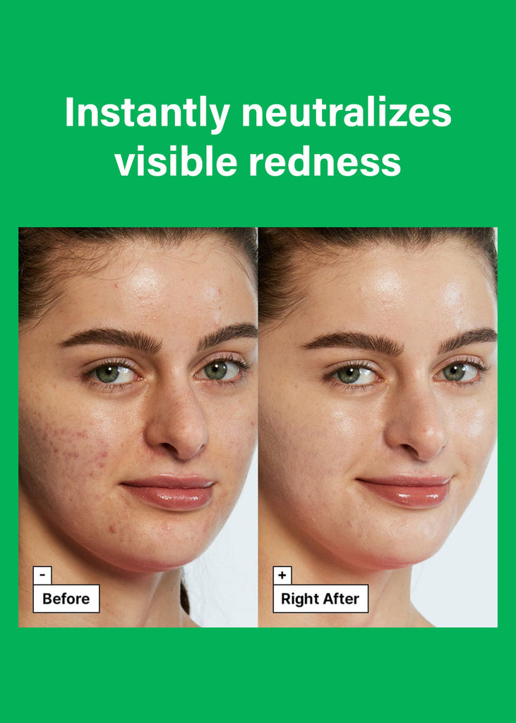 Dr. Jart+ Cicapair Tiger Grass Color Correcting Treatment 50ml Seoul Scandal - Shop Miss A