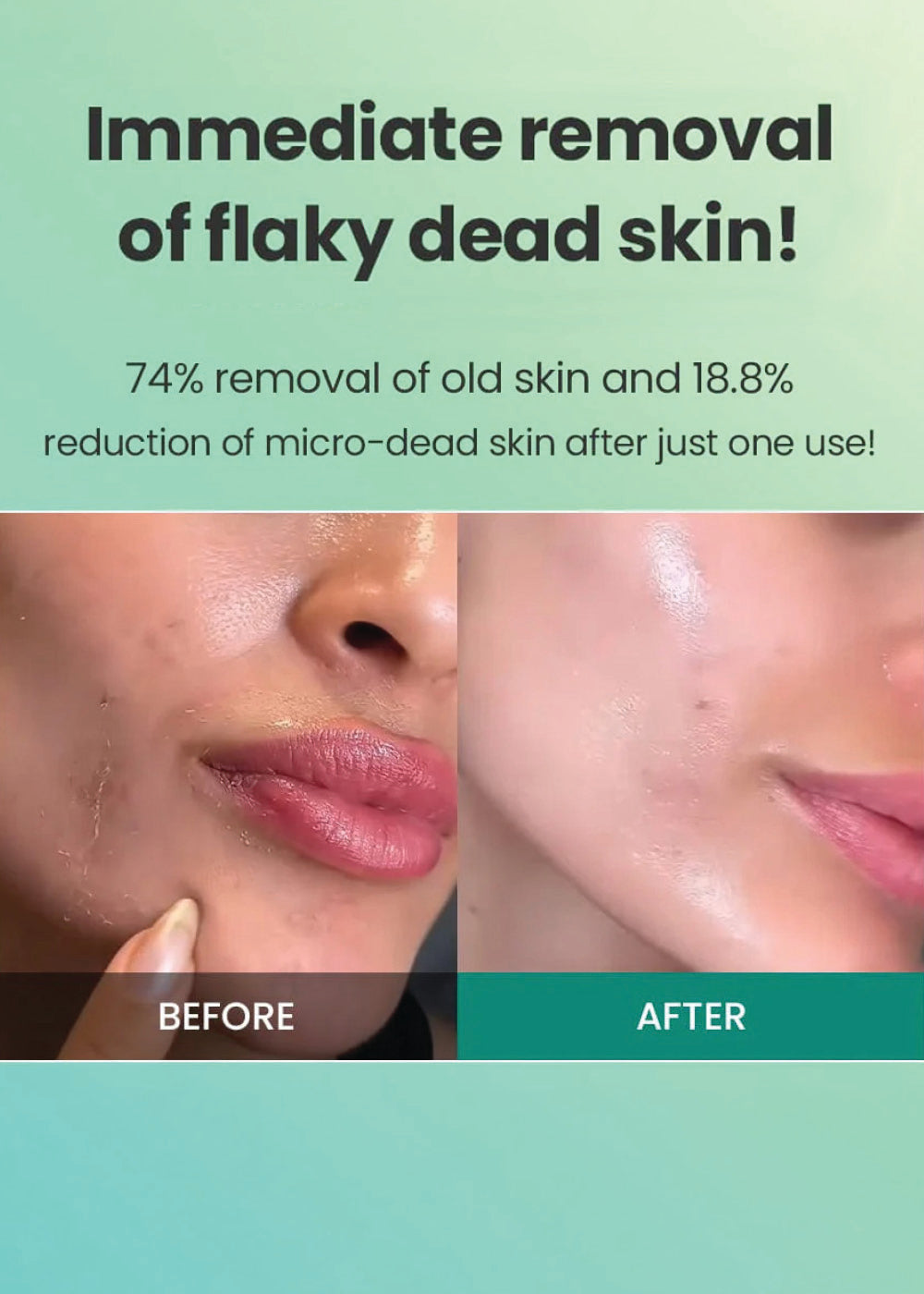 Dr.G Brightening Peeling Gel 120g – Shop Miss A