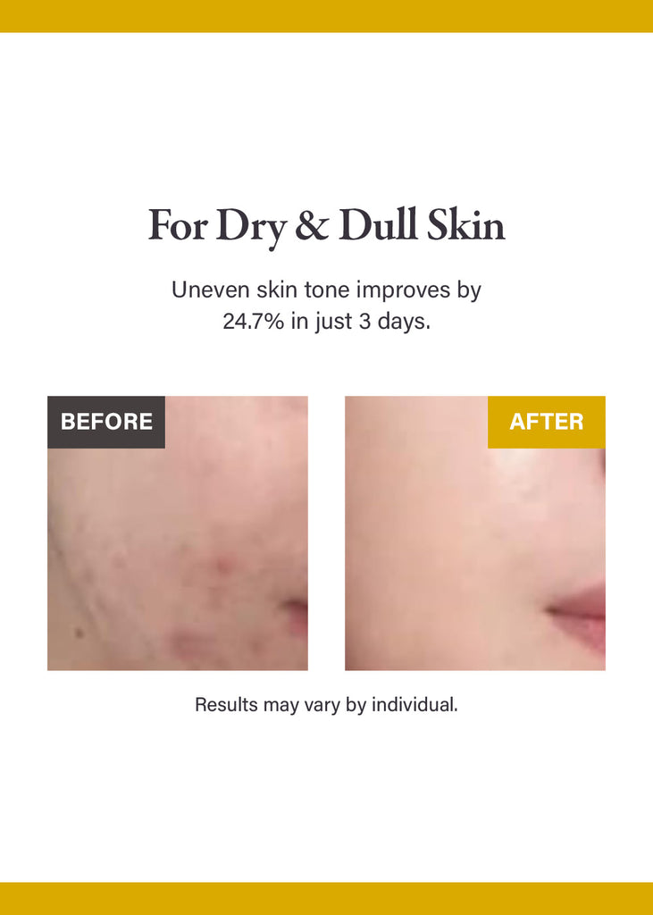 medicube Kojic Acid Turmeric Night Wrapping Mask 75ml Seoul Scandal - Shop Miss A