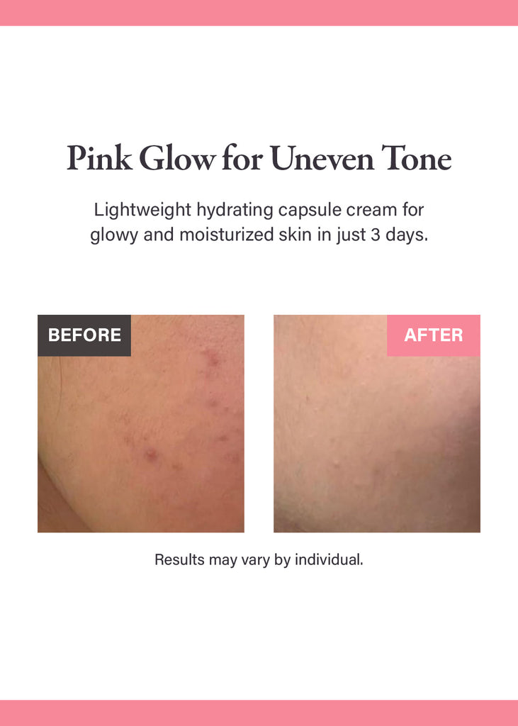 medicube PDRN Pink Collagen Capsule Cream 55g Seoul Scandal - Shop Miss A