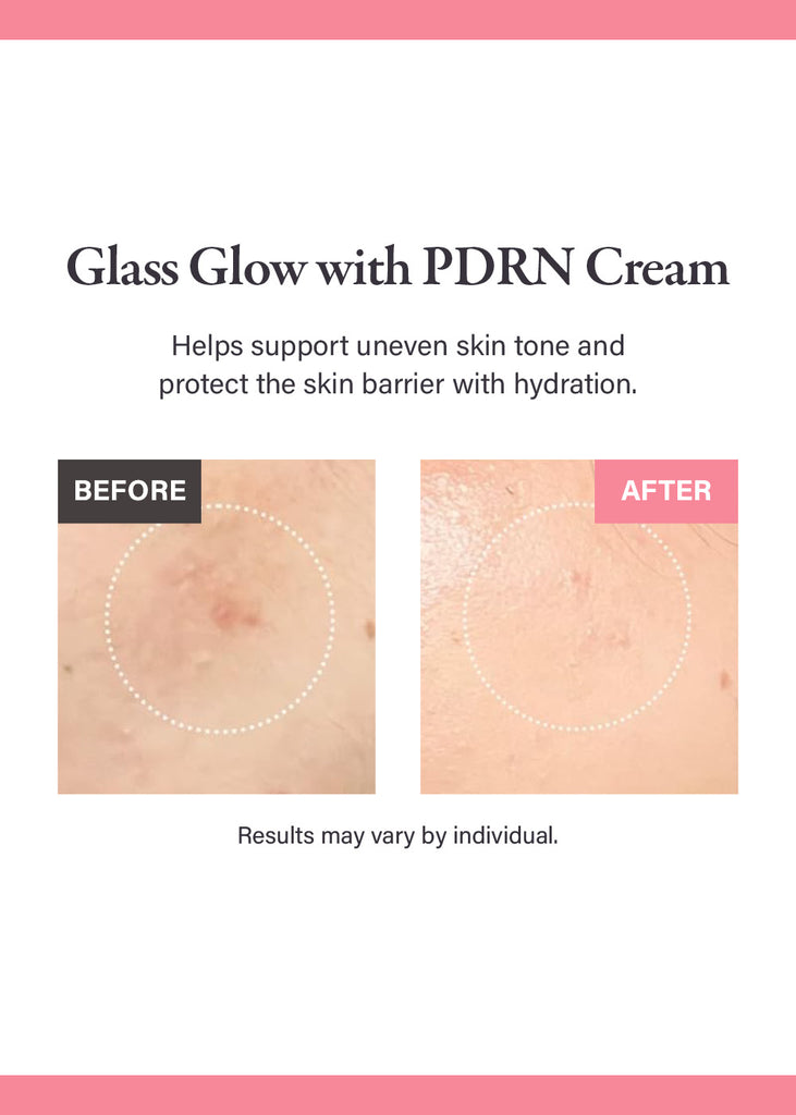 medicube PDRN Pink Hyaluronic Moisturizing Cream 50ml Seoul Scandal - Shop Miss A