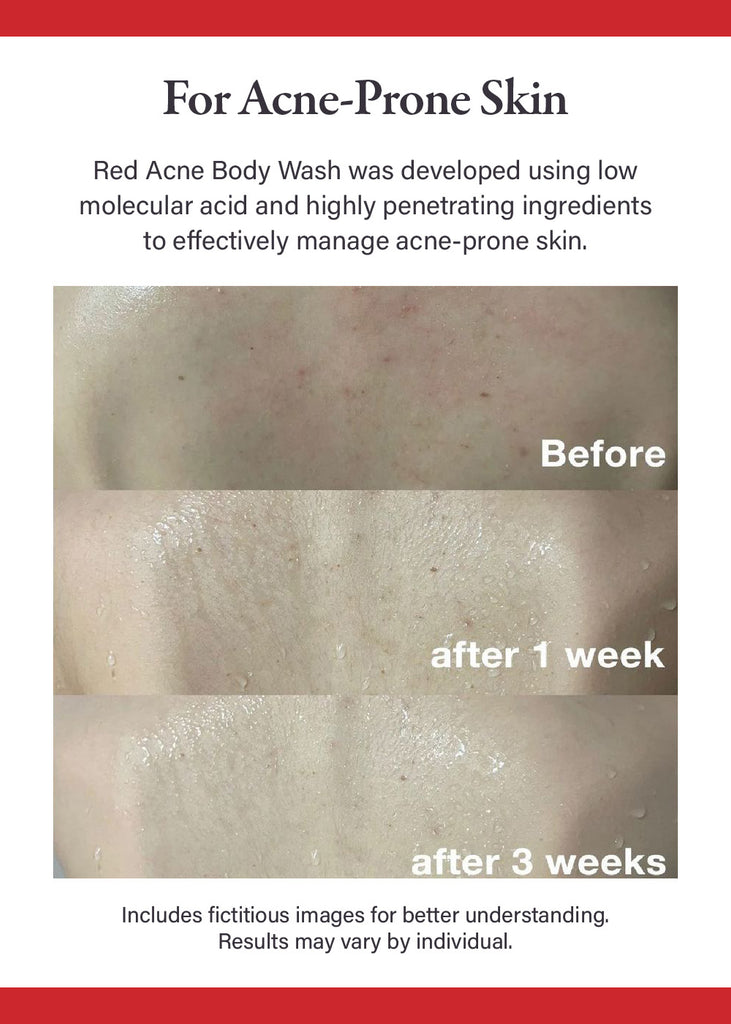 medicube Red Body Wash 400g Seoul Scandal - Shop Miss A