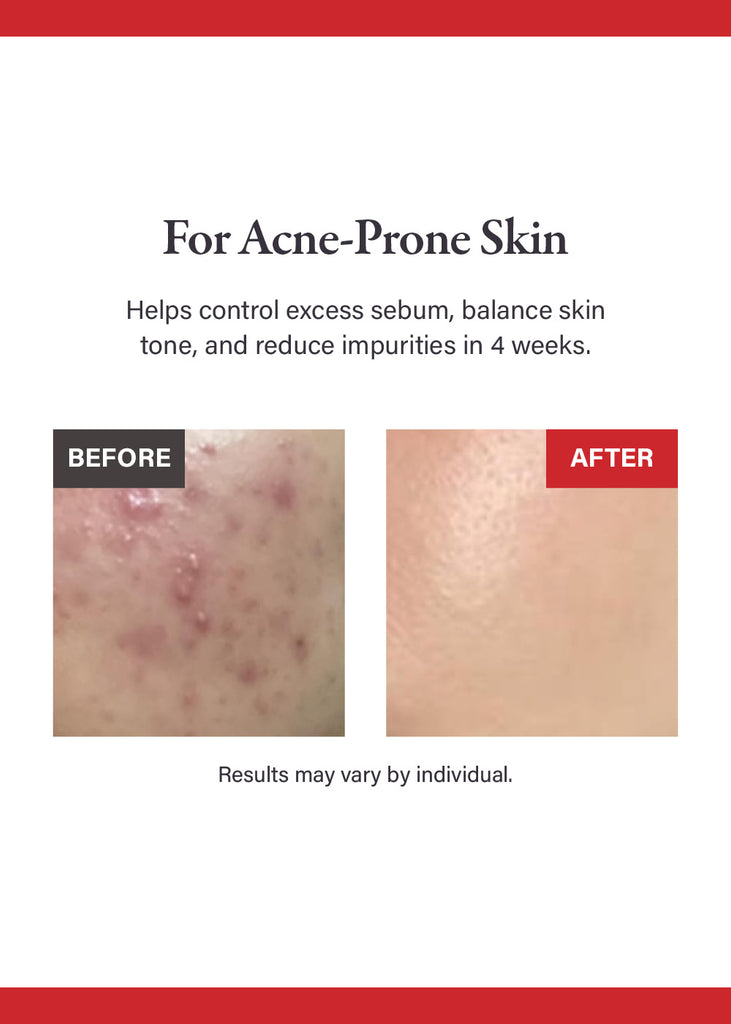 medicube Red Succinic Acid Peeling Pad (70 Pads) Seoul Scandal - Shop Miss A