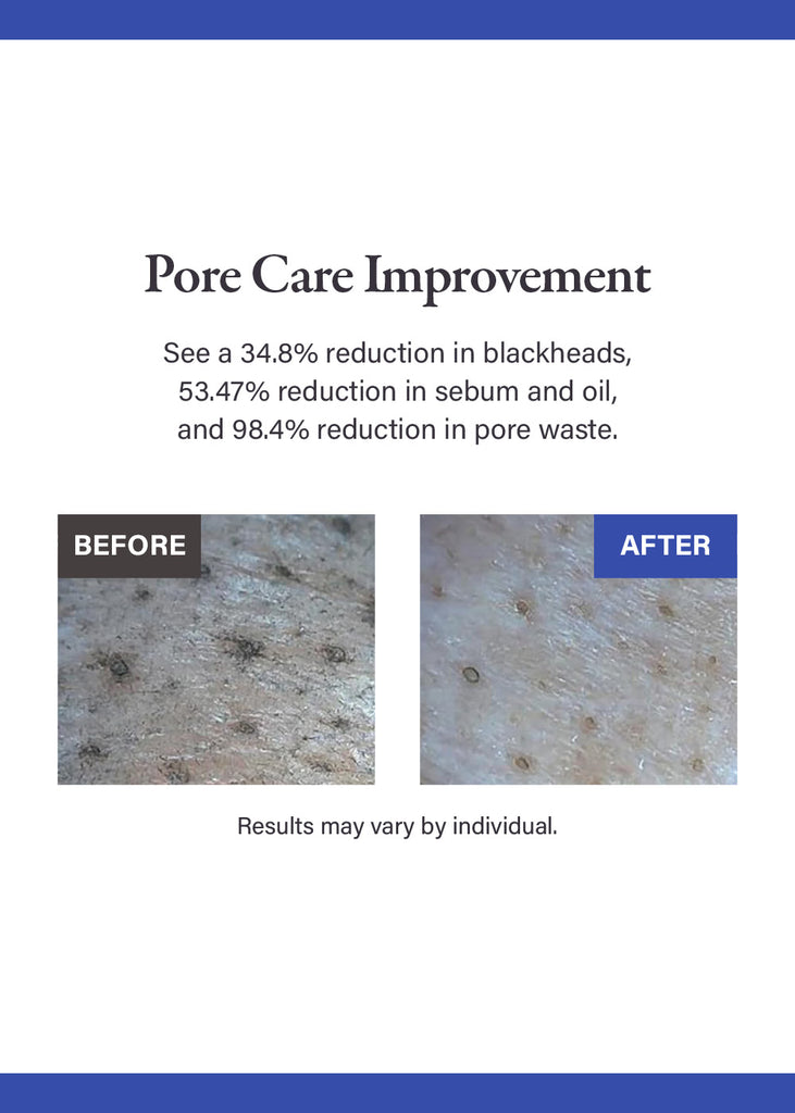 medicube Zero Pore Blackhead Mud Mask 100g Seoul Scandal - Shop Miss A