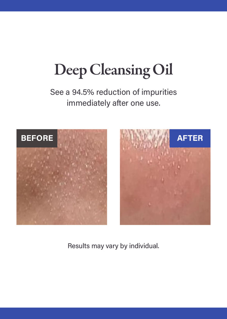 medicube Zero Pore Blackhead Deep Cleansing Oil 205ml Seoul Scandal - Shop Miss A