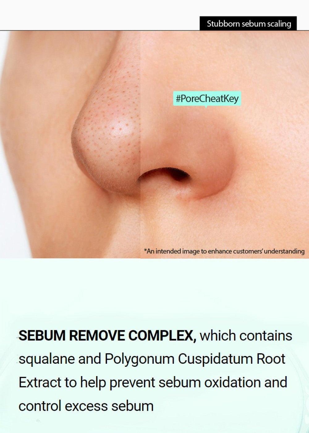 Sebum Excess